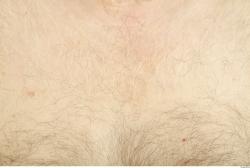 Hairy Skins